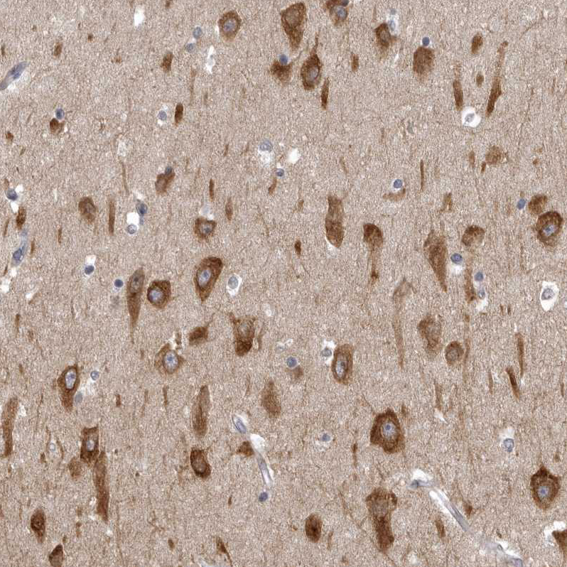 Staining of human hippocampus shows strong cytoplasmic positivity in neuronal cells.