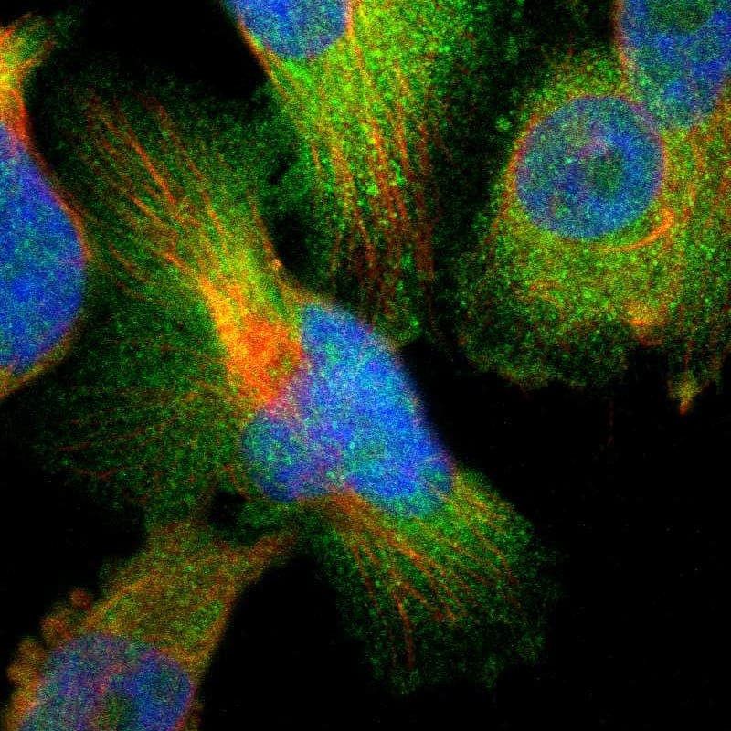 Staining of human cell line U-251 MG shows localization to cytosol.