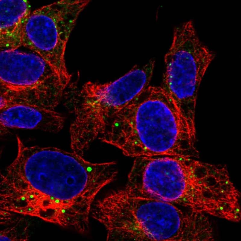 Staining of human cell line Hep G2 shows localization to vesicles.