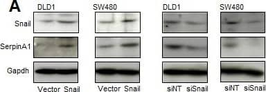 Western Blot: Serpin A1/alpha 1-Antitrypsin Antibody [NBP1-90309] - SerpinA1 was regulated by SnailA. DLD-1 & SW480 cells were transfected with pcDNA-Snail (Snail), control vector pcDNA (vector), Snail siRNA (siSnail), or nontargeting siRNA (siNT), & Snail & serpinA1 protein levels were evaluated by western blot analysis. B. DLD-1 & SW480 cells were transfected with pcDNA-serpinA1 (serpinA1), control vector pcDNA (vector), serpinA1 siRNA (siSerpinA1), or nontargeting siRNA (siNT), & western blot analysis was performed for detection of Snail & SerpinA1 expression. C. DLD-1 & SW480 cells were transfected with pcDNA-Snail (Snail) or control vector pcDNA (vector), & ChIP assays were performed. The presence of the serpinA1 promoter (−516/−4) was verified in immunoprecipitates with either mouse IgG or anti-Snail antibodies, & assay inputs were analyzed using real-time PCR. The samples were loaded on agarose gels. D. Data show promoter enrichment in the anti-Snail immunoprecipitate relative to IgG. Image collected & cropped by CiteAb from the following publication (//pubmed.ncbi.nlm.nih.gov/26015410), licensed under a CC-BY license. Not internally tested by Novus Biologicals.