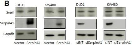 Western Blot: Serpin A1/alpha 1-Antitrypsin Antibody [NBP1-90309] - SerpinA1 was regulated by SnailA. DLD-1 & SW480 cells were transfected with pcDNA-Snail (Snail), control vector pcDNA (vector), Snail siRNA (siSnail), or nontargeting siRNA (siNT), & Snail & serpinA1 protein levels were evaluated by western blot analysis. B. DLD-1 & SW480 cells were transfected with pcDNA-serpinA1 (serpinA1), control vector pcDNA (vector), serpinA1 siRNA (siSerpinA1), or nontargeting siRNA (siNT), & western blot analysis was performed for detection of Snail & SerpinA1 expression. C. DLD-1 & SW480 cells were transfected with pcDNA-Snail (Snail) or control vector pcDNA (vector), & ChIP assays were performed. The presence of the serpinA1 promoter (−516/−4) was verified in immunoprecipitates with either mouse IgG or anti-Snail antibodies, & assay inputs were analyzed using real-time PCR. The samples were loaded on agarose gels. D. Data show promoter enrichment in the anti-Snail immunoprecipitate relative to IgG. Image collected & cropped by CiteAb from the following publication (//pubmed.ncbi.nlm.nih.gov/26015410), licensed under a CC-BY license. Not internally tested by Novus Biologicals.