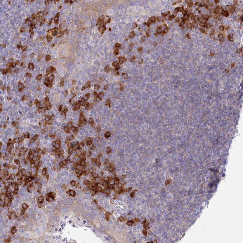 Staining of human tonsil shows strong cytoplasmic positivity in non-germinal center cells.