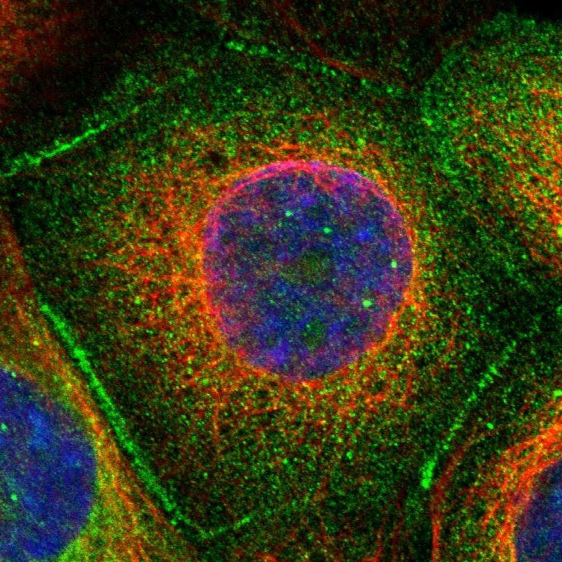 Immunocytochemistry/ Immunofluorescence 53BP2 Antibody - BSA Free