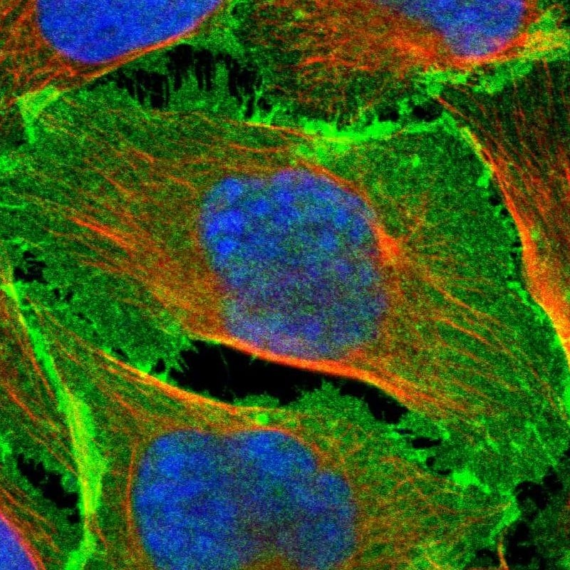 Staining of human cell line U-2 OS shows localization to plasma membrane & cell junctions.
