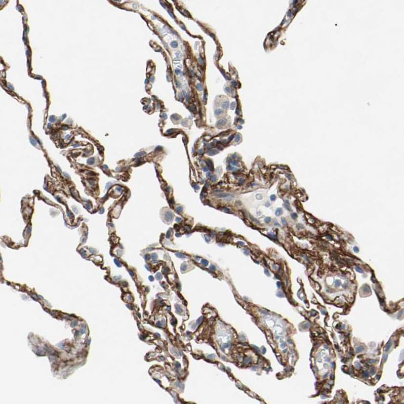 Immunohistochemistry EPB4IL2 Antibody - BSA Free