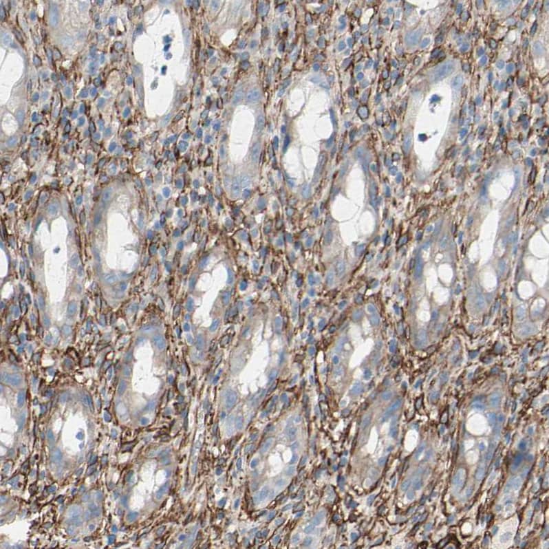 Immunohistochemistry EPB4IL2 Antibody - BSA Free