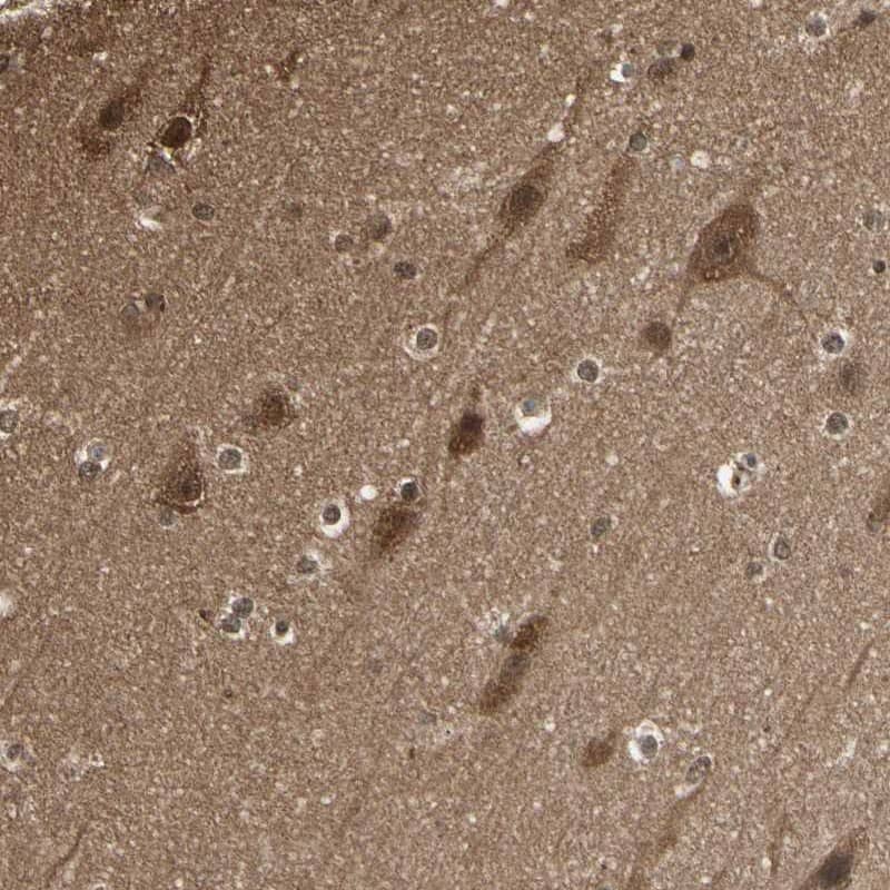 Staining of human cerebral cortex shows strong cytoplasmic positivity in neuronal cells and glial cells.