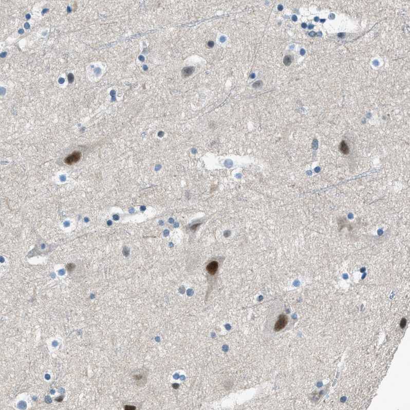 Immunohistochemistry Zeta Opioid Receptor Antibody - BSA Free