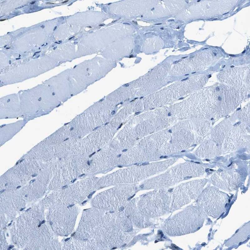 Immunohistochemistry Zeta Opioid Receptor Antibody - BSA Free