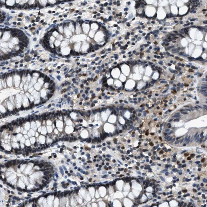Immunohistochemistry Zeta Opioid Receptor Antibody - BSA Free