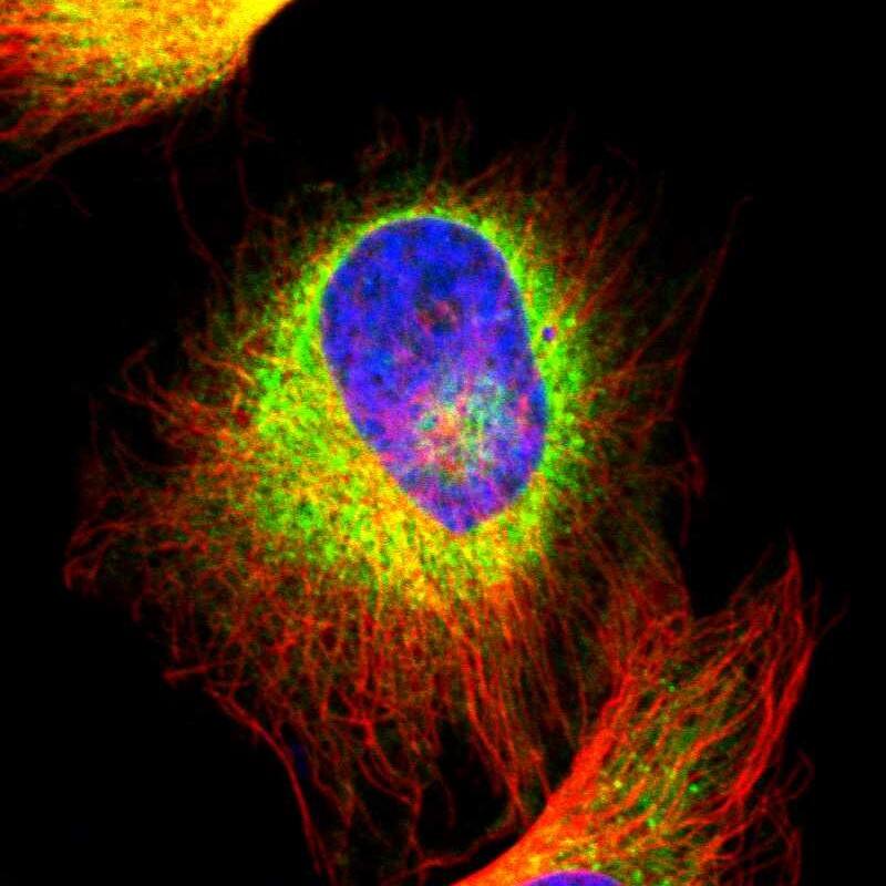 Staining of human cell line U-251 MG shows localization to endoplasmic reticulum.