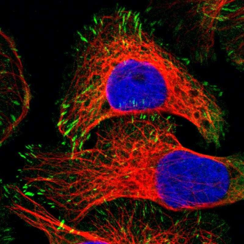 Staining of human cell line U-2 OS shows localization to focal adhesion sites.