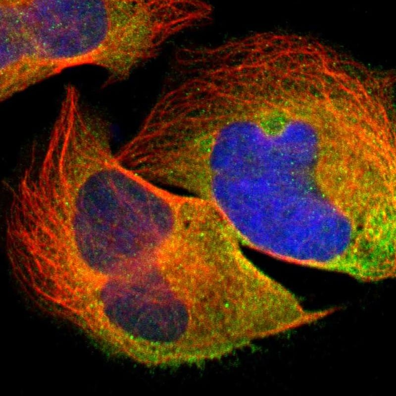 Staining of human cell line U-2 OS shows localization to cytosol.