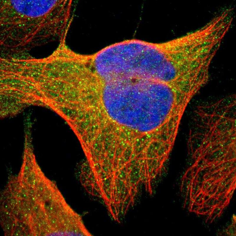 Staining of human cell line U-2 OS shows localization to cytosol.