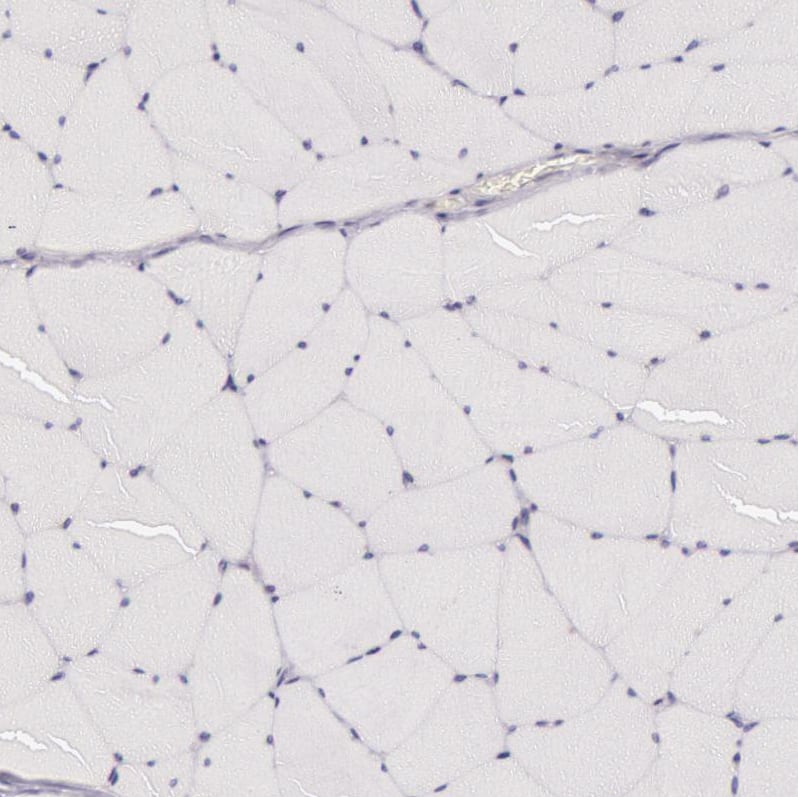 Staining of human skeletal muscle shows no cytoplasmic positivity in myocytes as expected.