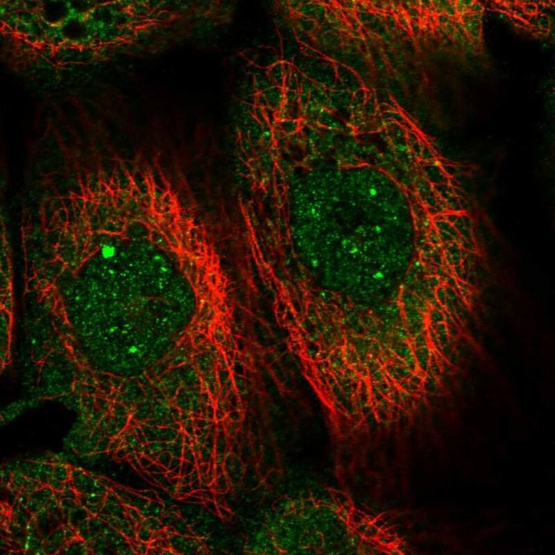 Staining of human cell line A-431 shows localization to nuclear bodies & cytosol.