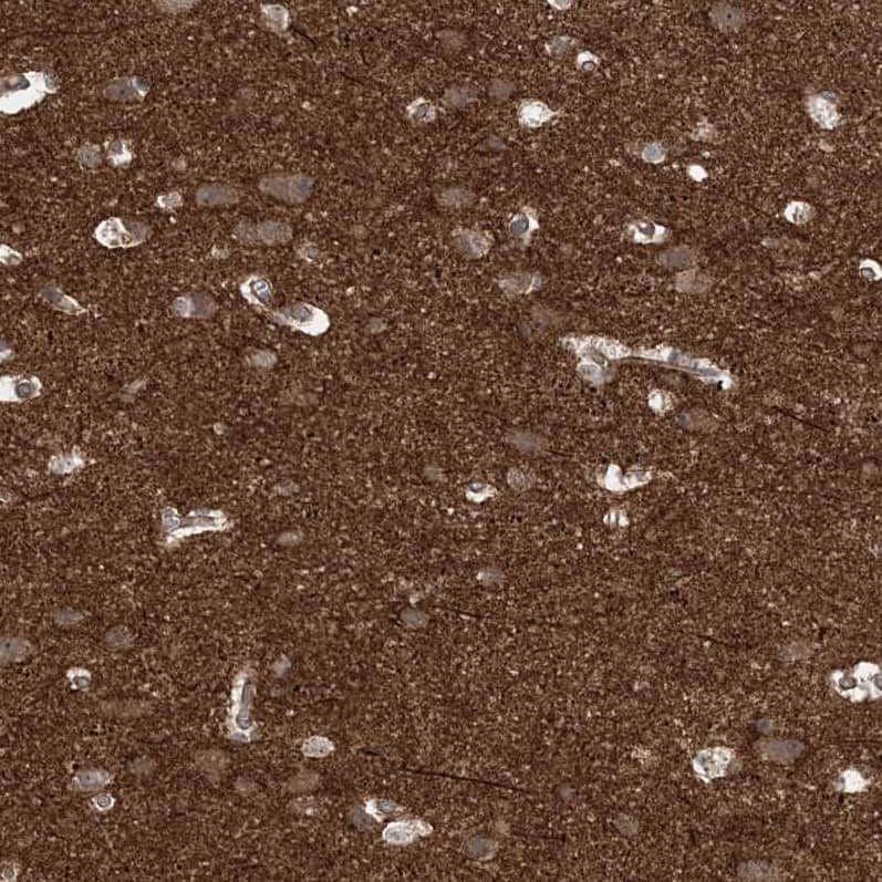 Immunohistochemistry Gemin 5 Antibody - BSA Free