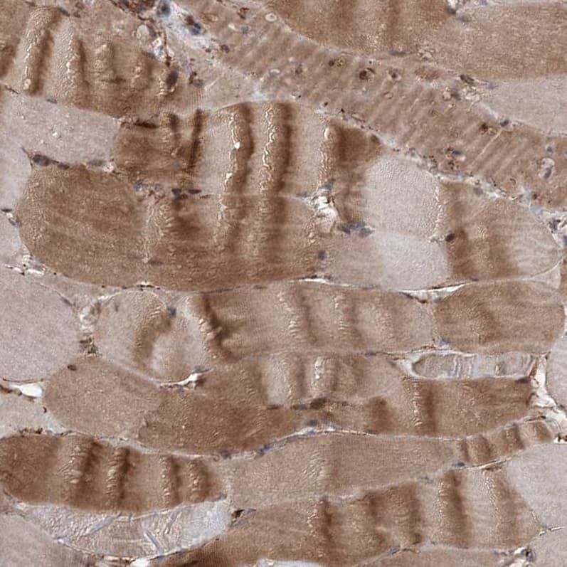 Immunohistochemistry Gemin 5 Antibody - BSA Free