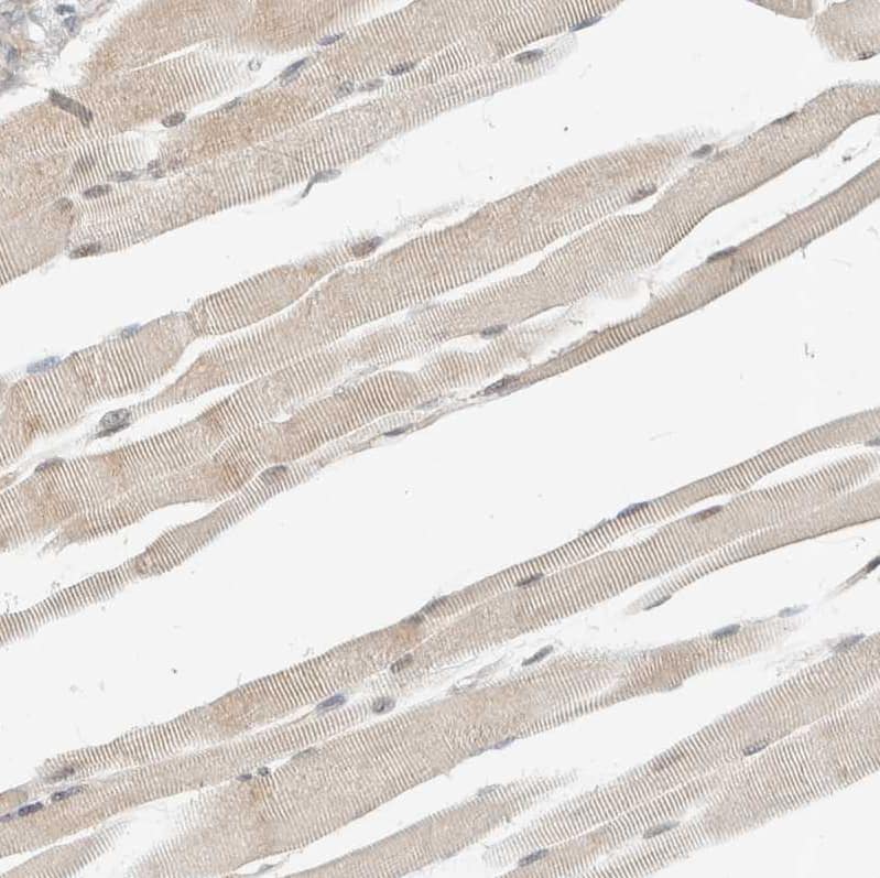 Staining of human skeletal muscle shows weak cytoplasmic positivity in myocytes.