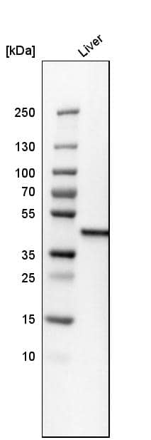 Analysis in human liver tissue.