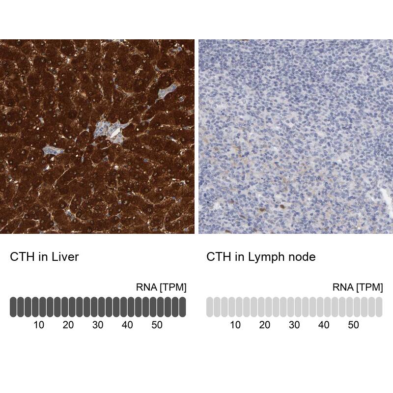 <b>Independent Antibodies Validation and Orthogonal Strategies Validation.</b>Analysis in human liver and lymph node tissues using Anti-CTH antibody. Corresponding CTH RNA-seq data are presented for the same tissues.