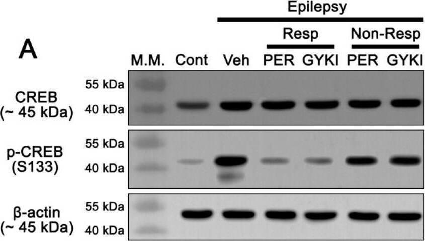 The effects of perampanel (PER) and GYKI 52,466 (GYKI) on total Ca2+/cAMP response element-binding protein (CREB) and its S133 phosphorylation in chronic epilepsy rats. Both AMPAR antagonists reduce CREB S133 phosphorylation in responders (Resp), but not non-responders (Non-Resp). (A) Representative images for Western blot of CREB and p-CREB levels in the hippocampal tissues. (B–F) Quantifications of CREB (B), p-CREB S133 (C), and p-CREB S133 ratio (D) levels in the hippocampal tissues. Open circles indicate each individual value. Horizontal bars indicate mean value. Error bars indicate SEM (*, # p < 0.05 vs. control and vehicle (Veh)-treated animals, respectively; one-way ANOVA with post hoc Bonferroni’s multiple comparison). Image collected and cropped by CiteAb from the following open publication (//pubmed.ncbi.nlm.nih.gov/33348808), licensed under a CC-BY license. Not internally tested by Novus Biologicals.