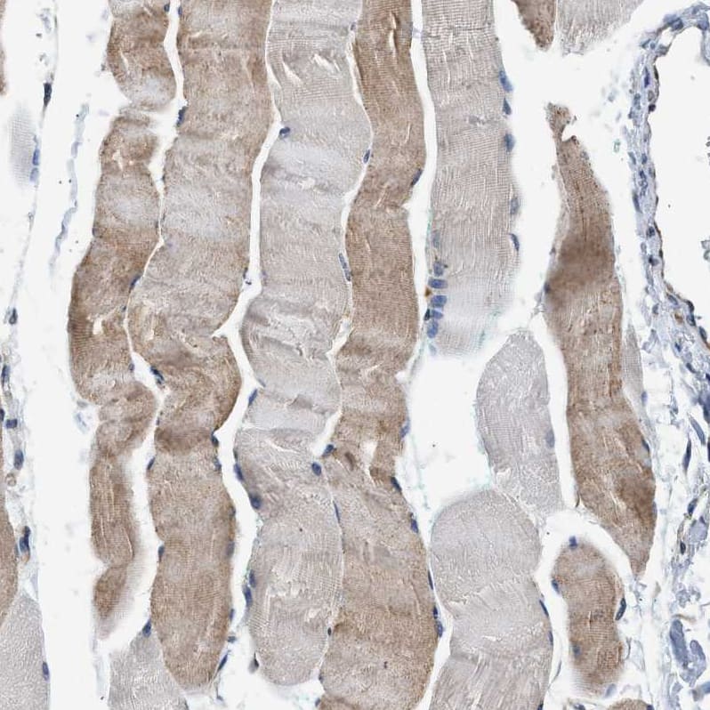 Staining of human Skeletal muscle shows moderate cytoplasmic positivity in myocytes.