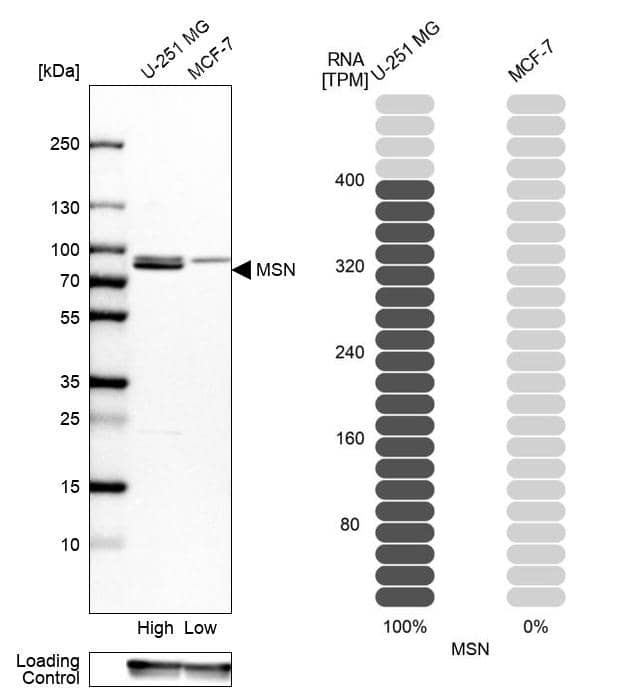 <b>Orthogonal Strategies Validation. </b>Analysis in human cell lines U-251MG and MCF-7 using Anti-MSN antibody. Corresponding MSN RNA-seq data are presented for the same cell lines. Loading control: Anti-GAPDH.