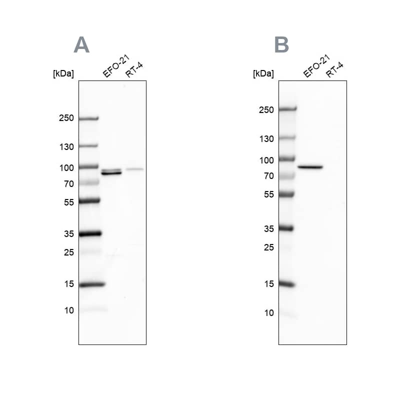 <b>Independent Antibodies Validation. </b>Analysis using antibody NBP1-90372 (A) shows similar pattern to independent antibody NBP1-90373 (B).
