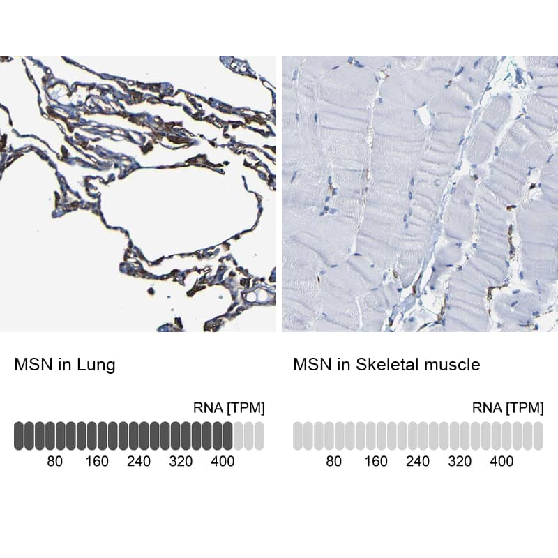 <b>Orthogonal Strategies Validation. </b>Analysis in human lung and skeletal muscle tissues using NBP1-90373 antibody. Corresponding MSN RNA-seq data are presented for the same tissues.