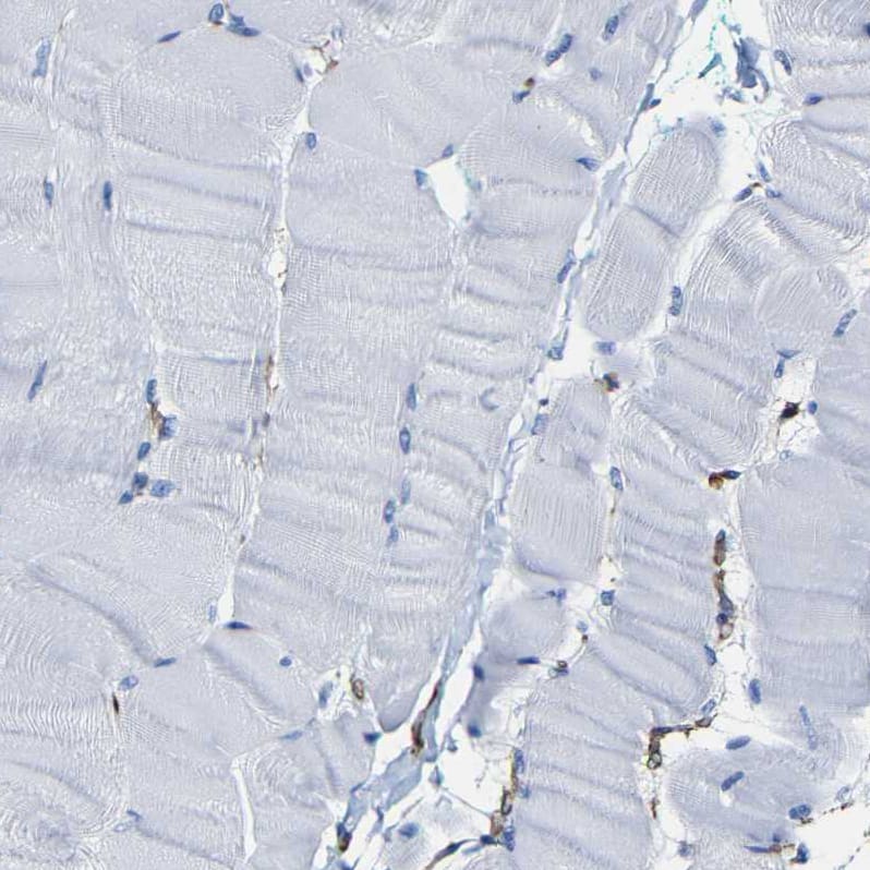 Staining of human skeletal muscle shows no positivity in myocytes as expected.