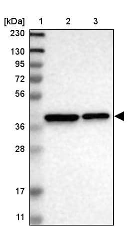 Lane 1: Marker [kDa] 230, 130, 95, 72, 56, 36, 28, 17, 11Lane 2: Human cell line RT-4Lane 3: Human cell line U-251MG sp