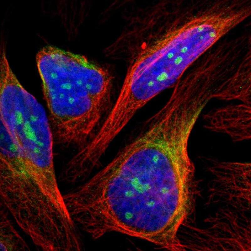 Staining of human cell line U-2 OS shows localization to nucleoli & intermediate filaments.