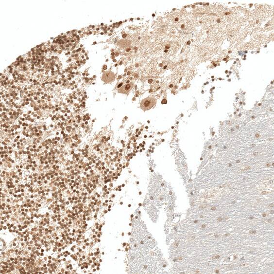 Immunohistochemistry RESF1 Antibody - BSA Free