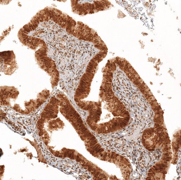 Immunohistochemistry RESF1 Antibody - BSA Free