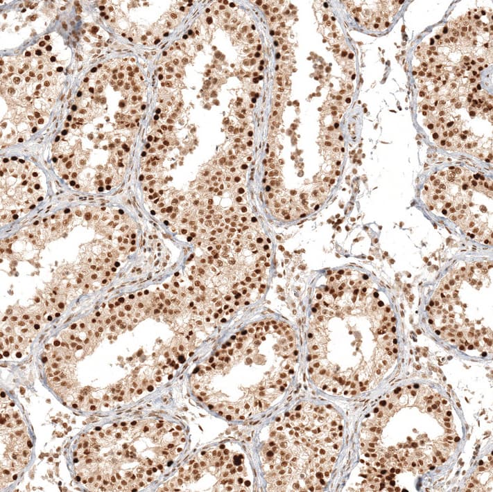 Immunohistochemistry RESF1 Antibody - BSA Free