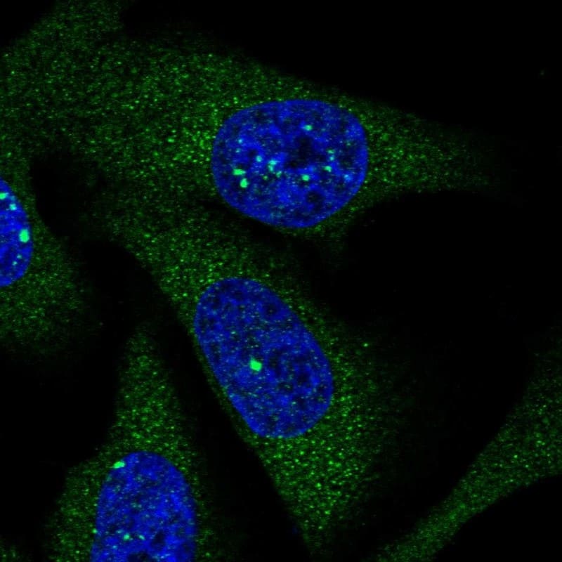Staining of human cell line U-2 OS shows positivity in nucleus & cytoplasm.