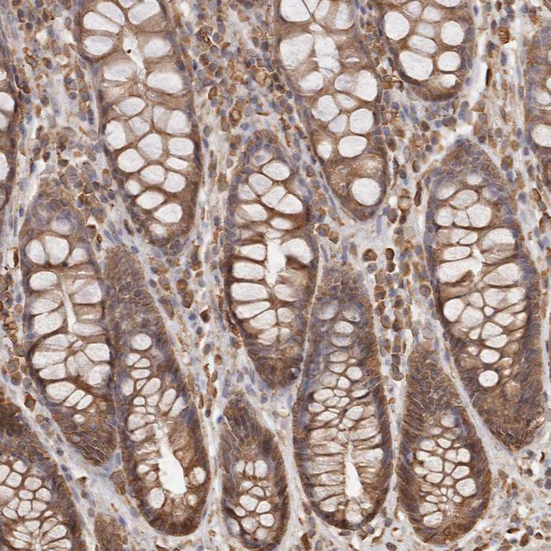 Staining of human rectum shows moderate cytoplasmic positivity in glandular cells.
