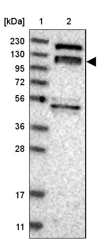 Lane 1: Marker [kDa] 230, 130, 95, 72, 56, 36, 28, 17, 11Lane 2: Human cell line RT-4