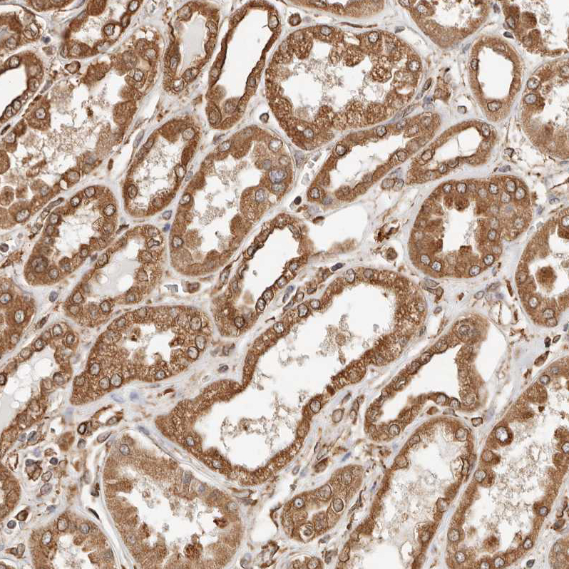 Staining of human kidney shows moderate cytoplasmic positivity in cells in tubules.