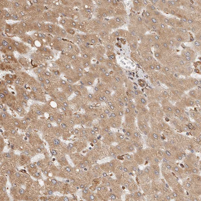 Staining of human liver shows weak cytoplasmic positivity in hepatocytes.