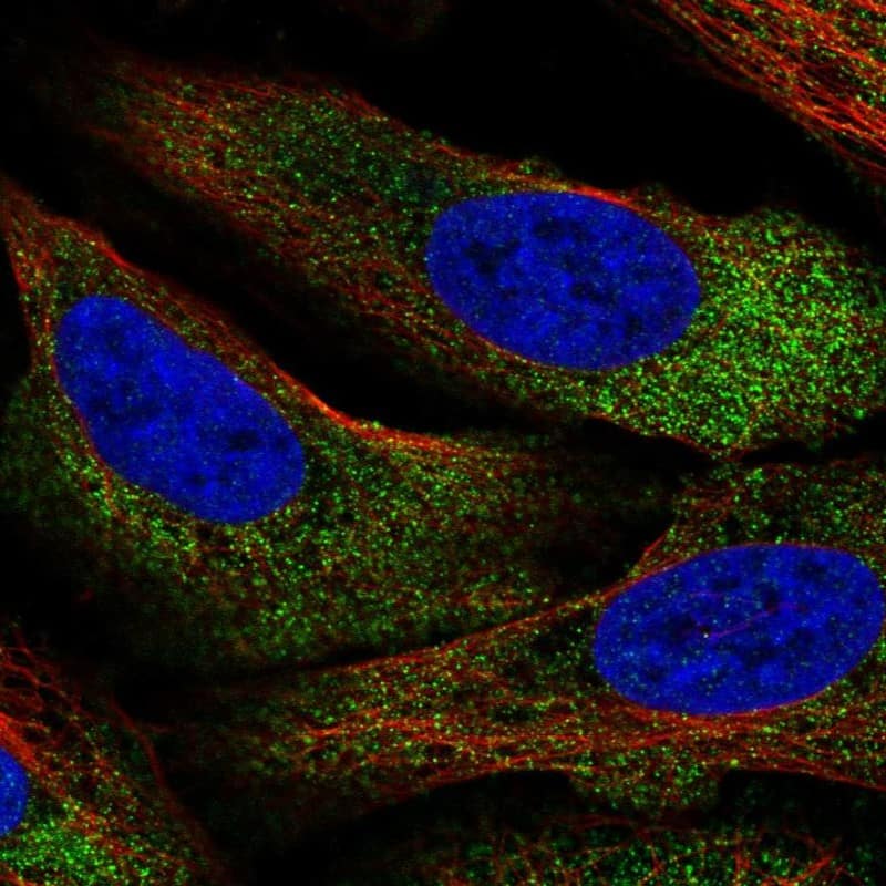 Staining of human cell line U-2 OS shows localization to cytosol.