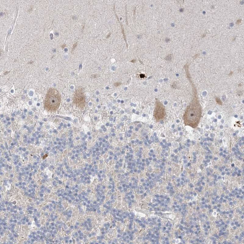 Immunohistochemistry-Paraffin SDAD1 Antibody - BSA Free