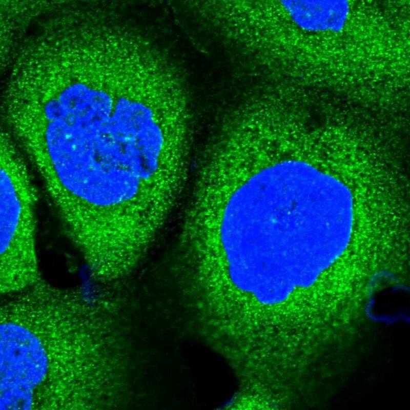Staining of human cell line A-431 shows localization to cytosol.
