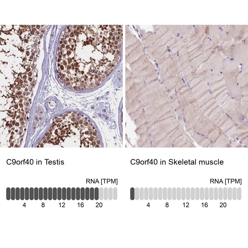 Analysis in human testis and skeletal muscle tissues using Anti-C9orf40 antibody. Corresponding C9orf40 RNA-seq data are presented for the same tissues.