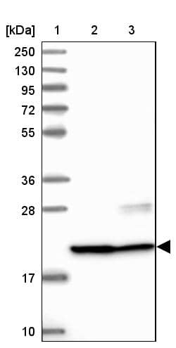 Lane 1: Marker [kDa] 250, 130, 95, 72, 55, 36, 28, 17, 10Lane 2: Human cell line RT-4Lane 3: Human cell line U-251MG sp