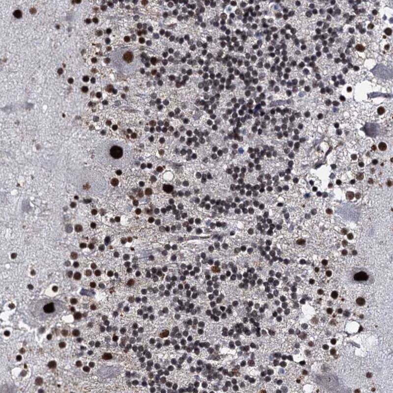 Immunohistochemistry-Paraffin RUFY2 Antibody - BSA Free