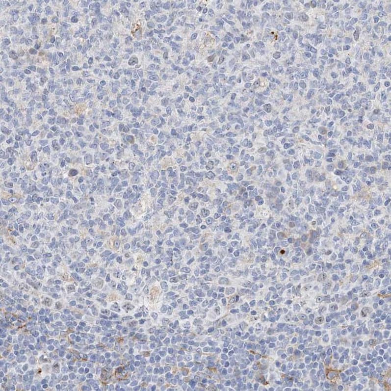 Staining of human tonsil shows no membranous positivity in germinal center cells as expected.