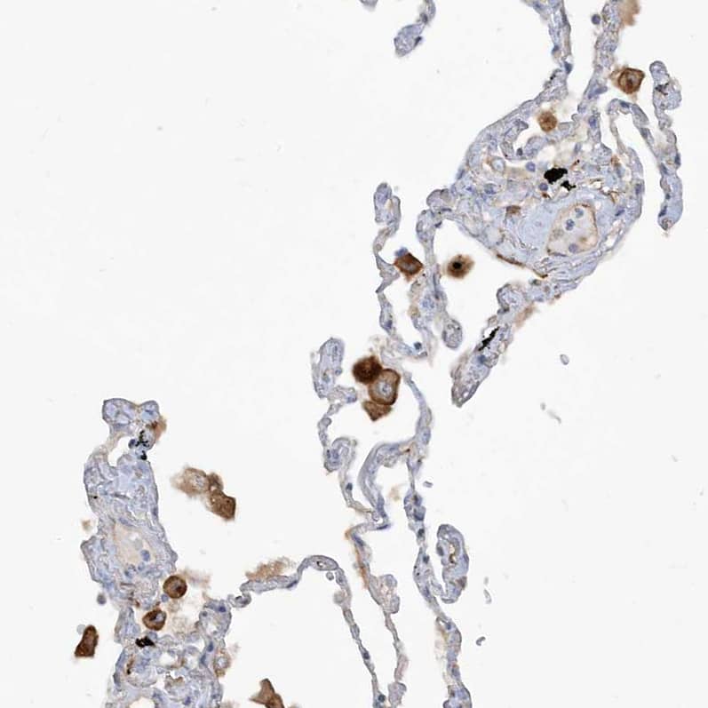 Staining of human lung shows moderate membranous positivity in macrophages.