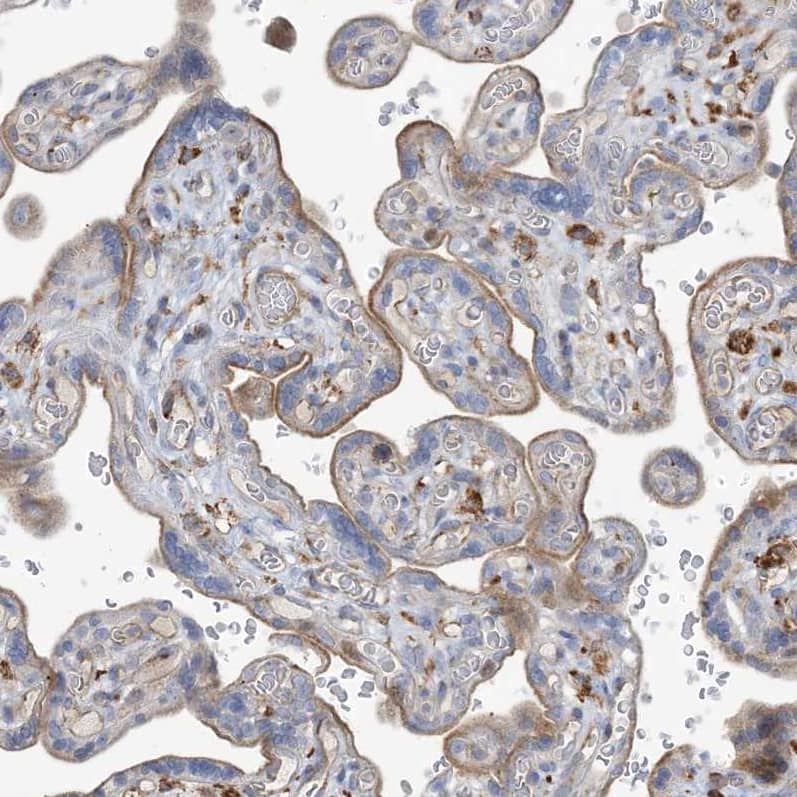 Staining of human placenta shows  moderate membranous positivity in trophoblastic cells.